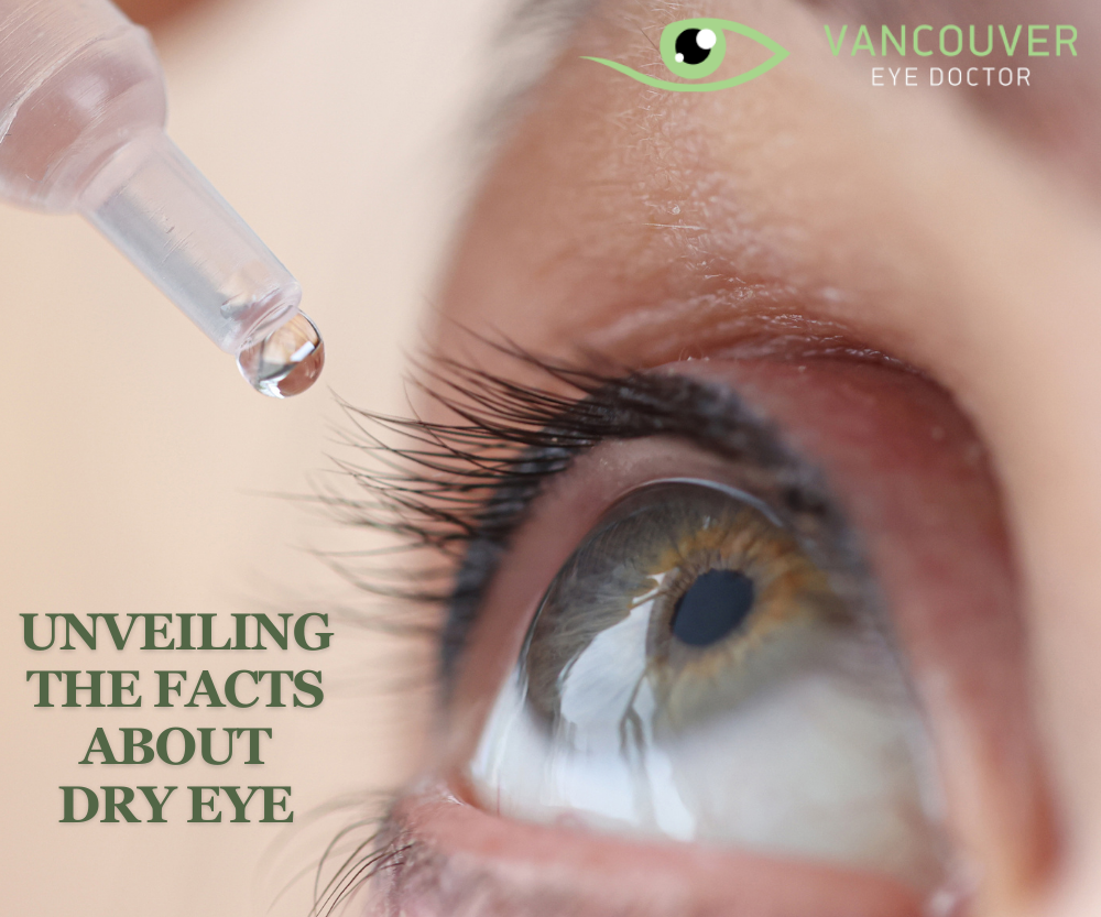Unveiling the Facts About Dry Eye