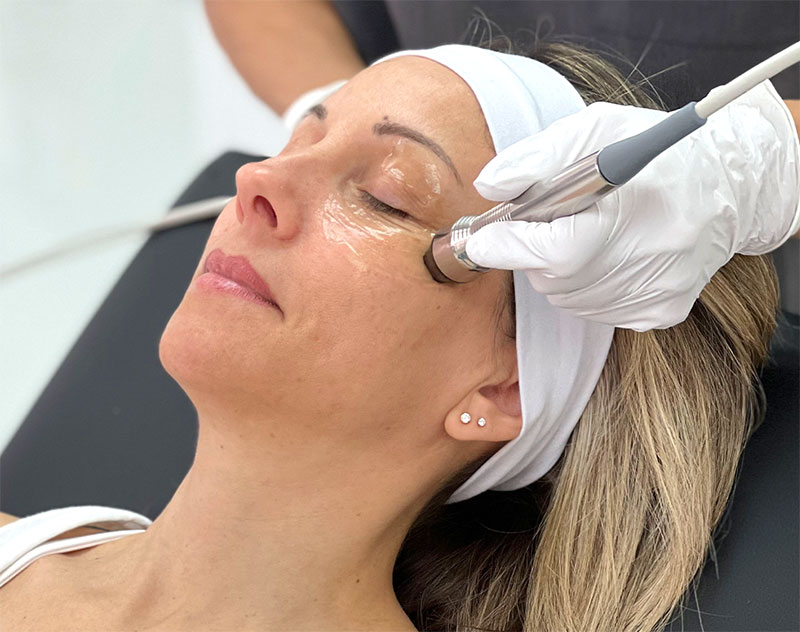 Forma-I radiofrequency therapy for dry eye handpiece